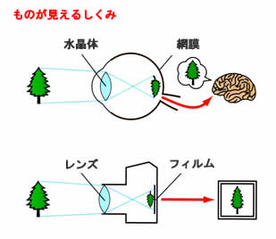 網膜剥離画像