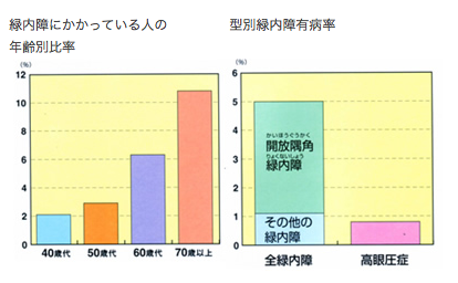 緑内障画像